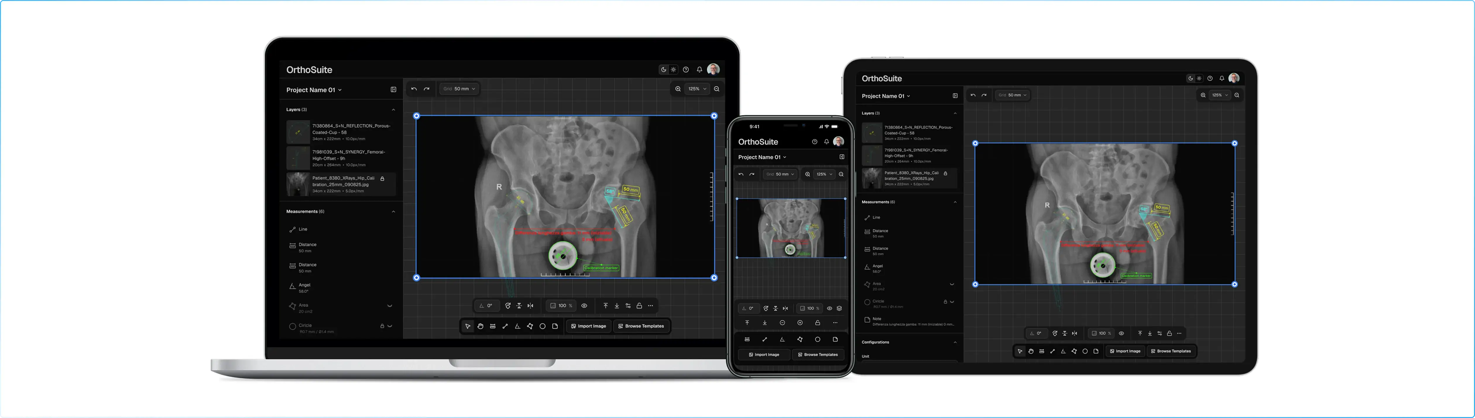 Orthopedic Preoperative Planning App
